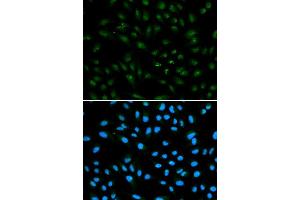 Immunofluorescence analysis of A549 cell using AR antibody. (Androgen Receptor 抗体)