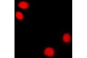 Immunofluorescent analysis of Reptin 52 staining in U2OS cells. (RUVBL2 抗体)