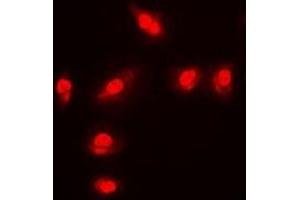 Immunofluorescent analysis of FOXO1 (pS256) staining in MCF7 cells. (FOXO1 抗体  (pSer256))