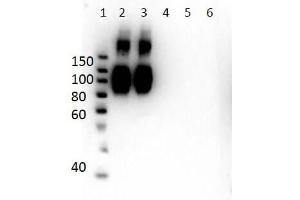Western Blot of Mouse Anti-Hemoglobin A (beta chain) Antibody. (Hemoglobin Subunit beta 抗体  (N-Term))