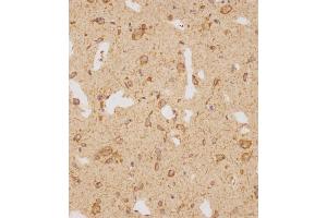 Immunohistochemical analysis of (ABIN1539214 and ABIN2838155) on paraffin-embedded human brain tissue was performed on the Leica®BOND RXm. (GATSL2 抗体  (N-Term))