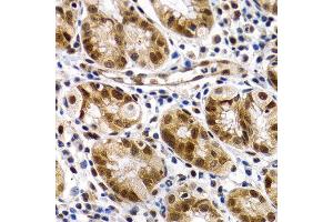 Immunohistochemistry of paraffin-embedded human normal stomach using MT2A antibody at dilution of 1:200 (400x lens). (MT2A 抗体)