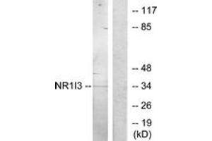 Western blot analysis of extracts from Jurkat cells, treated with serum 20% 15', using NR1I3 Antibody. (NR1I3 抗体  (AA 71-120))
