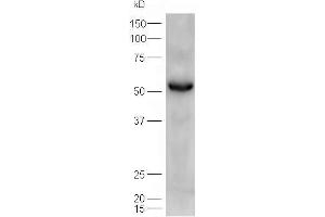 Lane 1: mouse heart  probed with Rabbit Anti-ATGL/Adipose Triglyceride Lipase Polyclonal Antibody, Unconjugated (ABIN704756) at 1:300 overnight at 4 °C. (PNPLA2 抗体  (AA 401-504))