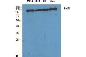 Western Blot (WB) analysis of specific cells using BM28 Polyclonal Antibody. (MCM2 抗体  (N-Term))