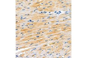 Immunohistochemistry of paraffin embedded rat heart using SCN4b (ABIN7075646) at dilution of 1:2000 (300x lens) (SCN4B 抗体)