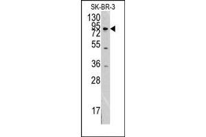Image no. 1 for anti-Discoidin Domain Receptor tyrosine Kinase 1 (DDR1) antibody (ABIN359899) (DDR1 抗体)