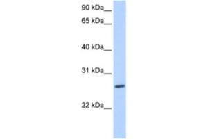 Western Blotting (WB) image for anti-Zinc Finger Protein 664 (ZNF664) antibody (ABIN2463457) (ZNF664 抗体)