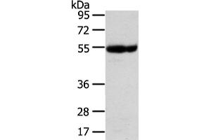 Western Blotting (WB) image for anti-Ubiquitin Associated Protein 1 (UBAP1) antibody (ABIN5961309) (UBAP1 抗体)