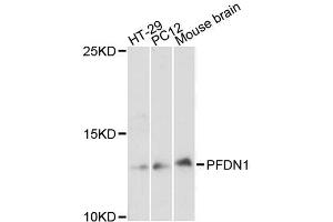 Western blot analysis of extracts of various cell lines, using PFDN1 antibody (ABIN5996513) at 1:3000 dilution. (PFDN1 抗体)