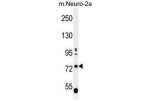 Western Blotting (WB) image for anti-Leucine-Rich Repeat and WD Repeat-Containing Protein 1 (LRWD1) antibody (ABIN2996388) (LRWD1 抗体)