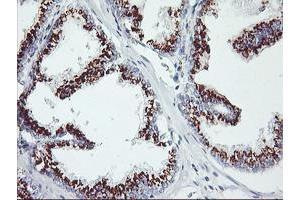 Image no. 1 for anti-Golgi Membrane Protein 1 (GOLM1) antibody (ABIN1498497) (GOLM1 抗体)