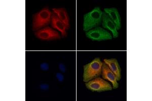 Transferrin Antibody staining Hela cells by IF/ICC. (Transferrin 抗体  (Internal Region))