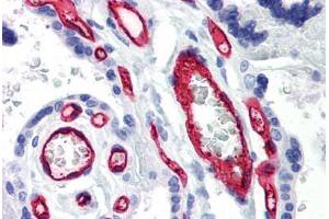 Human Placenta (formalin-fixed, paraffin-embedded) stained with CD34 antibody ABIN239805 at 10 ug/ml followed by biotinylated anti-mouse IgG secondary antibody ABIN481714, alkaline phosphatase-streptavidin and chromogen.