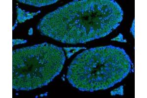 IF analysis of DDX4/MVH using anti-DDX4/MVH antibody (ABIN7601204). (DDX4 抗体  (AA 3-666))