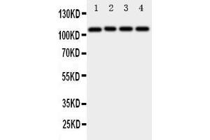 Anti-ADAM19 antibody, Western blotting Lane 1: Rat Spleen Tissue Lysate Lane 2: Rat Intestine Tissue Lysate Lane 3: Rat Brain Tissue Lysate Lane 4: HELA Cell Lysate (ADAM19 抗体  (N-Term))