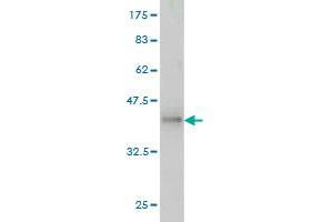 Western Blot detection against Immunogen (36. (ACTN1 抗体  (AA 543-639))