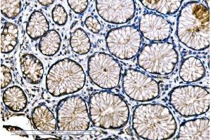 IHC analysis of SNAP23 using anti-SNAP23 antibody (ABIN7603236).