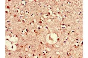Immunohistochemistry of paraffin-embedded human brain tissue using ABIN7169149 at dilution of 1:100 (PIM3 抗体  (AA 278-326))