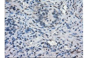 Immunohistochemical staining of paraffin-embedded colon tissue using anti-PORmouse monoclonal antibody. (POR 抗体)