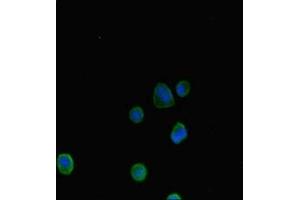 Immunofluorescent analysis of MCF-7 cells using ABIN7144657 at dilution of 1:100 and Alexa Fluor 488-congugated AffiniPure Goat Anti-Rabbit IgG(H+L) (Aryl Hydrocarbon Receptor 抗体  (AA 126-353))
