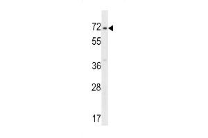 ZN Antibody (C-term) (ABIN1537388 and ABIN2848620) western blot analysis in HepG2 cell line lysates (35 μg/lane). (ZNF155 抗体  (C-Term))