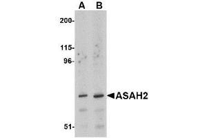Western blot analysis of ASAH2 in 293 cell lysate with AP30083PU-N ASAH2 antibody at (A) 1 and (B) 2 μg/ml. (ASAH2 抗体  (C-Term))