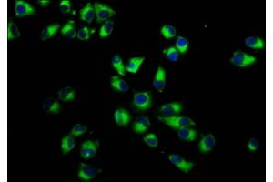 Immunofluorescence staining of Hela cells with ABIN7156450 at 1:233, counter-stained with DAPI. (ITGA7 抗体  (AA 175-283))