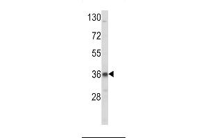 Western Blotting (WB) image for anti-Low Density Lipoprotein Receptor Adaptor Protein 1 (LDLRAP1) (AA 11-42), (N-Term) antibody (ABIN392553)
