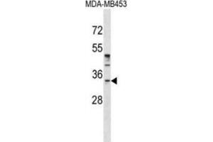 Western blot analysis in MDA-MB453 cell line lysates (35ug/lane) demonstrates that purified POU6F1 Antibody detects  POU6F1 protein (arrow). (POU6F1 抗体  (N-Term))