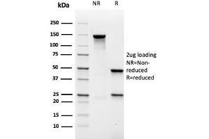 SDS-PAGE Analysis Purified MALT1 Recombinant Mouse Monoclonal Antibody (rMT1/410). (Recombinant MALT1 抗体  (AA 701-808))