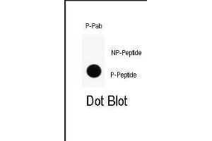 Image no. 1 for anti-Solute Carrier Family 29 (Nucleoside Transporters), Member 1 (SLC29A1) (pSer254) antibody (ABIN358541)