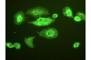 Detection of NQO1 in A549 cells using Polyclonal Antibody to NADH Dehydrogenase, Quinone 1 (NQO1) (NQO1 抗体  (AA 2-274))