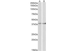 AP31421PU-N IDH3B antibody staining of Mouse Heart (A) and Mouse Muscle (B) lysate at 2 µg/ml (35µg protein in RIPA buffer). (IDH3B 抗体  (AA 33-46))
