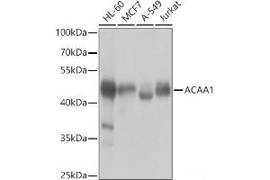 Western blot analysis of extracts of various cell lines using ACAA1 Polyclonal Antibody at dilution of 1:1000. (ACAA1 抗体)