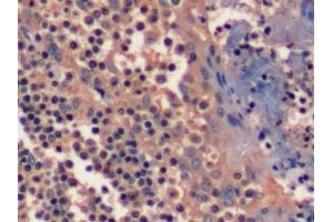 Detection of EGFR in Human Tonsil Tissue using Polyclonal Antibody to Epidermal Growth Factor Receptor (EGFR) (EGFR 抗体  (AA 888-1210))