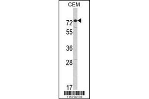 Western blot analysis of AMHR2 Antibody in CEM cell line lysates (35ug/lane)