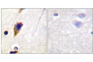 Immunohistochemistry analysis of paraffin-embedded human brain tissue, using Dynamin-1 (Ab-774) Antibody. (Dynamin 1 抗体  (AA 740-789))