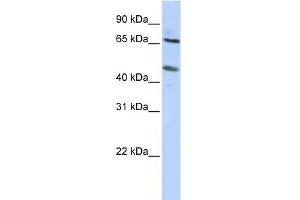 WB Suggested Anti-SLC26A10 Antibody Titration:  0. (SLC26A10 抗体  (N-Term))