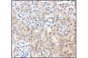 Immunohistochemistry of NPC1 in mouse kidney tissue with this product at 2.