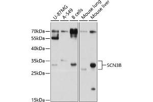 Western Blotting (WB) image for anti-Sodium Channel, Voltage-Gated, Type III, beta Subunit (SCN3B) (AA 23-160) antibody (ABIN6147441)