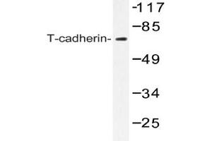 Image no. 1 for anti-Cadherin 13 (CDH13) antibody (ABIN272293) (Cadherin 13 抗体)