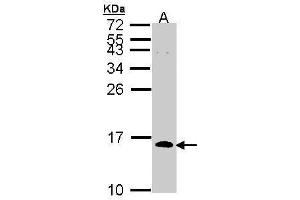 WB Image Sample (30 ug of whole cell lysate) A: H1299 15% SDS PAGE antibody diluted at 1:1000 (CDC26 抗体)