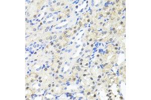 Immunohistochemistry of paraffin-embedded Mouse kidney using TRIM27 antibody (ABIN7269922) at dilution of 1:100 (40x lens). (TRIM27 抗体  (AA 1-200))