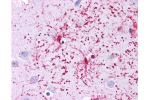 Immunohistochemistry (IHC) image for anti-Glutamate Dehydrogenase 1 (GLUD1) (N-Term) antibody (ABIN2782330) (GLUD1 抗体  (N-Term))