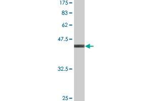 Western Blot detection against Immunogen (37. (Retinoic Acid Receptor alpha 抗体  (AA 315-424))