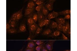 Immunofluorescence analysis of C6 cells using ACBD3 Polyclonal Antibody at dilution of 1:100. (ACBD3 抗体)