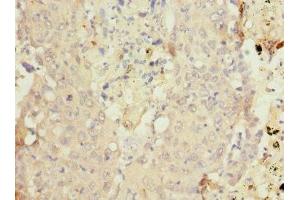 Immunohistochemistry (IHC) image for anti-Cytochrome P450, Family 4, Subfamily B, Polypeptide 1 (CYP4B1) (AA 30-250) antibody (ABIN7149271)