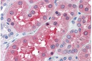 Human Kidney: Formalin-Fixed, Paraffin-Embedded (FFPE) (BBOX1 抗体  (AA 278-388))
