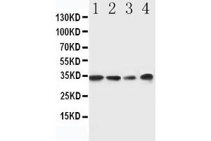 Anti-MyD88 antibody, Western blotting Lane 1: Rat Spleen Tissue Lysate Lane 2: Rat Thymus Tissue Lysate Lane 3: JURKAT Cell Lysate Lane 4: RAJI Cell Lysate (MYD88 抗体  (Middle Region))